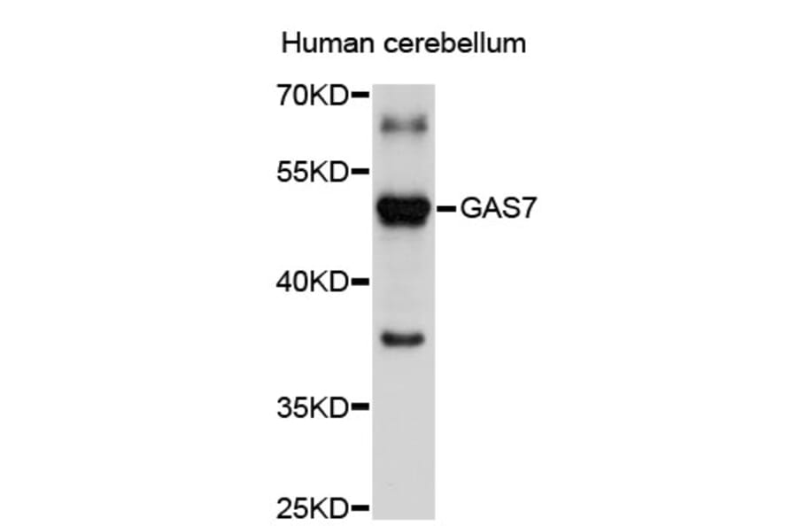 Western Blot - Anti-GAS7 Antibody (A2736) - Antibodies.com