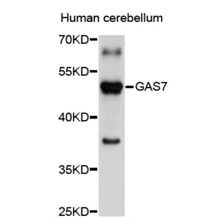 Western Blot - Anti-GAS7 Antibody (A2736) - Antibodies.com