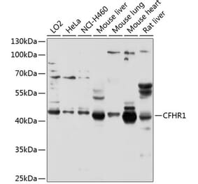 Western Blot - Anti-CFHR1 Antibody (A11557) - Antibodies.com