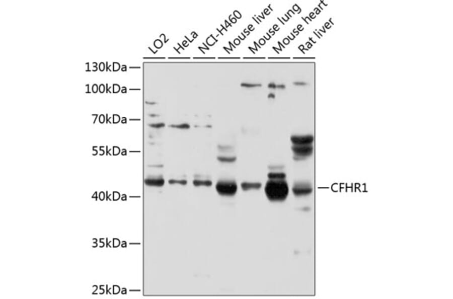 Western Blot - Anti-CFHR1 Antibody (A11557) - Antibodies.com