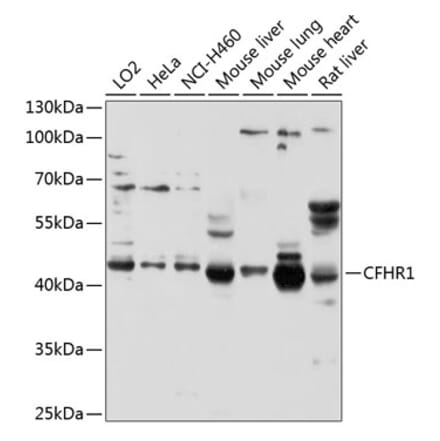 Western Blot - Anti-CFHR1 Antibody (A11557) - Antibodies.com