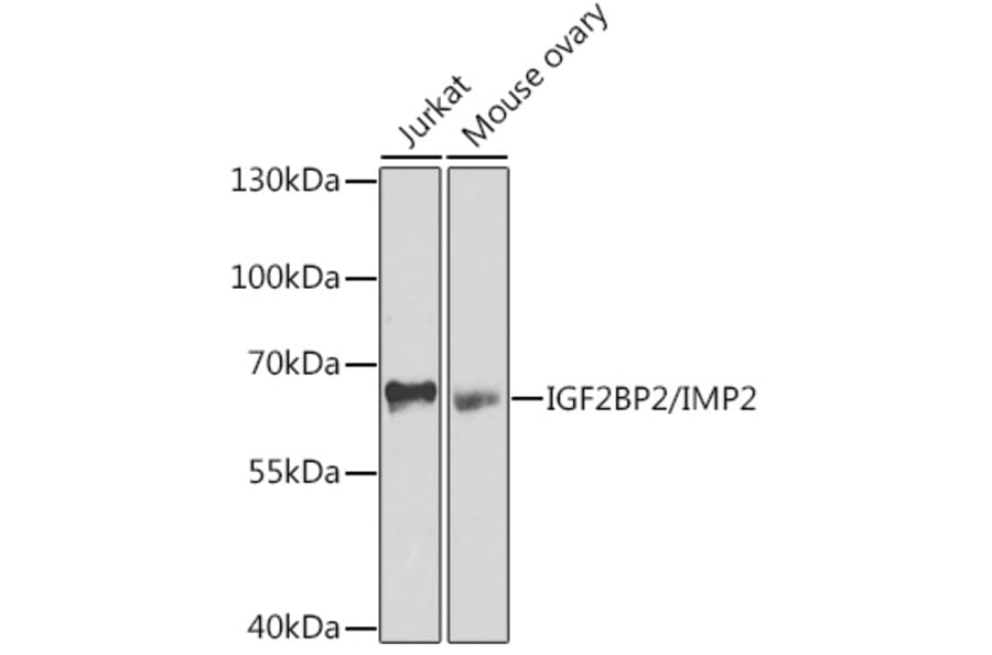 Western Blot - Anti-IGF2BP2/IMP-2 Antibody (A11558) - Antibodies.com