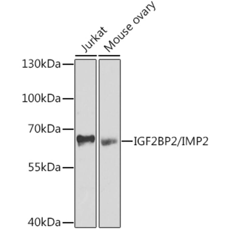 Western Blot - Anti-IGF2BP2/IMP-2 Antibody (A11558) - Antibodies.com