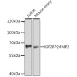 Western Blot - Anti-IGF2BP2/IMP-2 Antibody (A11558) - Antibodies.com