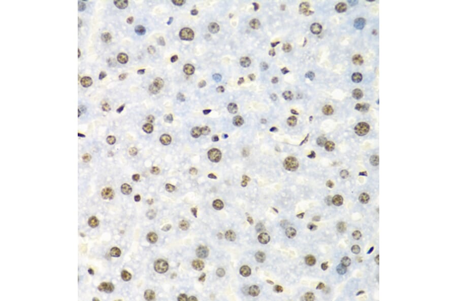 Immunohistochemistry - Anti-IGF2BP2/IMP-2 Antibody (A11558) - Antibodies.com