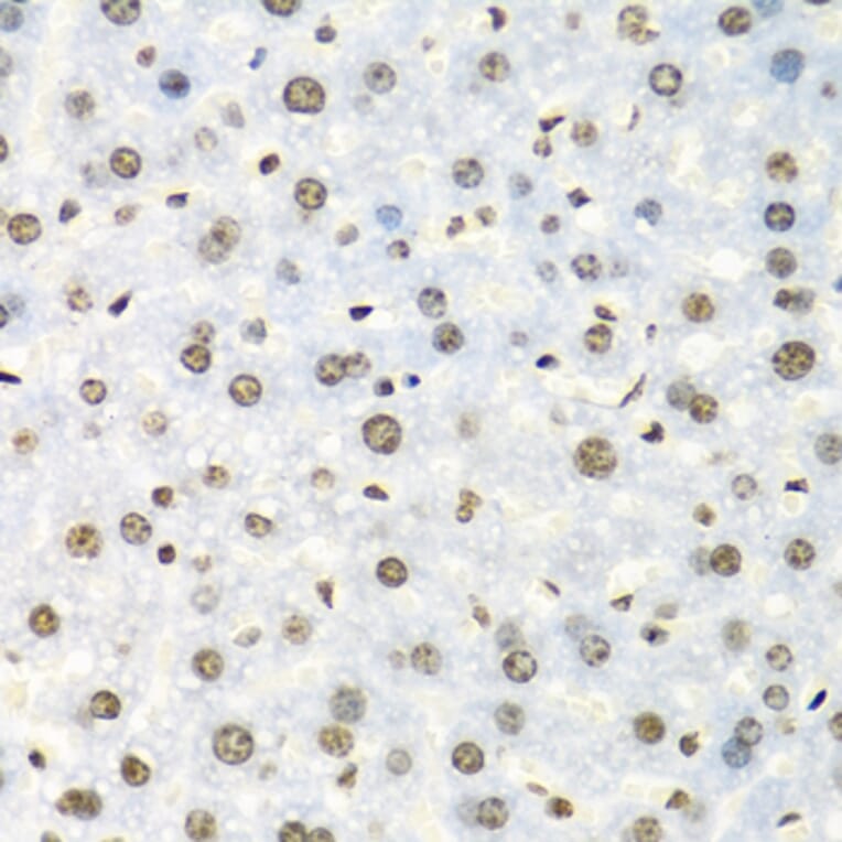Immunohistochemistry - Anti-IGF2BP2/IMP-2 Antibody (A11558) - Antibodies.com