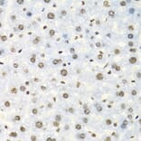 Immunohistochemistry - Anti-IGF2BP2/IMP-2 Antibody (A11558) - Antibodies.com