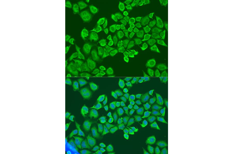 Immunofluorescence - Anti-IGF2BP2/IMP-2 Antibody (A11558) - Antibodies.com