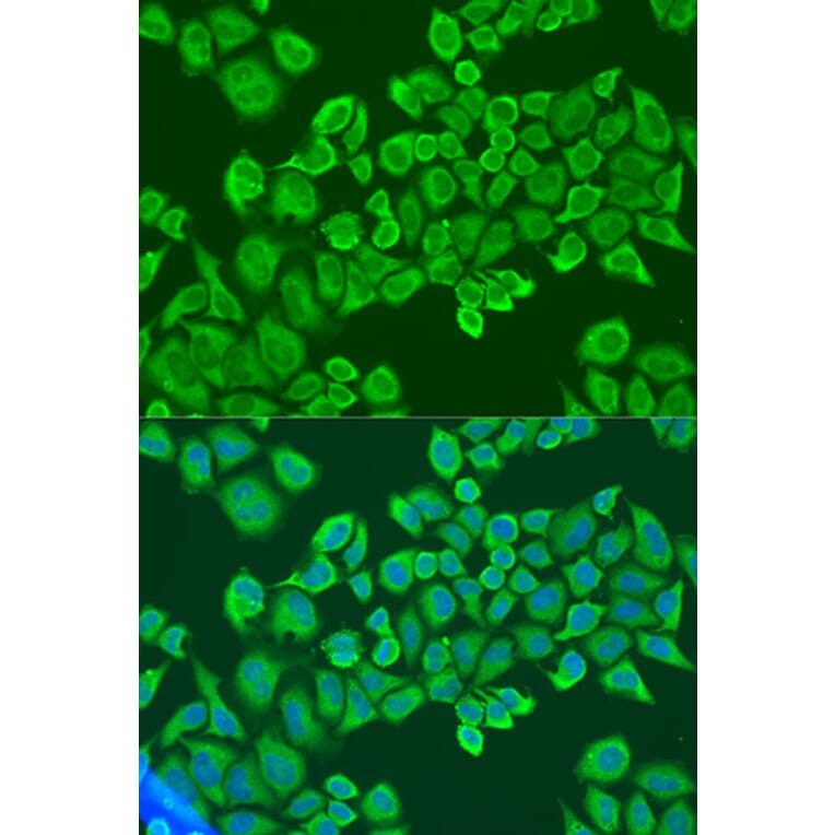 Immunofluorescence - Anti-IGF2BP2/IMP-2 Antibody (A11558) - Antibodies.com