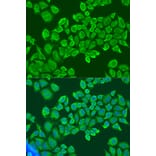 Immunofluorescence - Anti-IGF2BP2/IMP-2 Antibody (A11558) - Antibodies.com