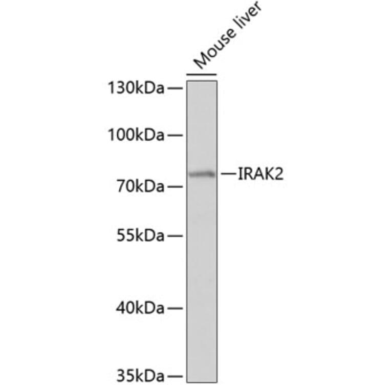 Western Blot - Anti-IRAK2 Antibody (A11559) - Antibodies.com