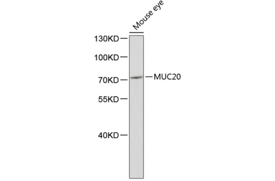 Western Blot - Anti-MUC20 Antibody (A2766) - Antibodies.com