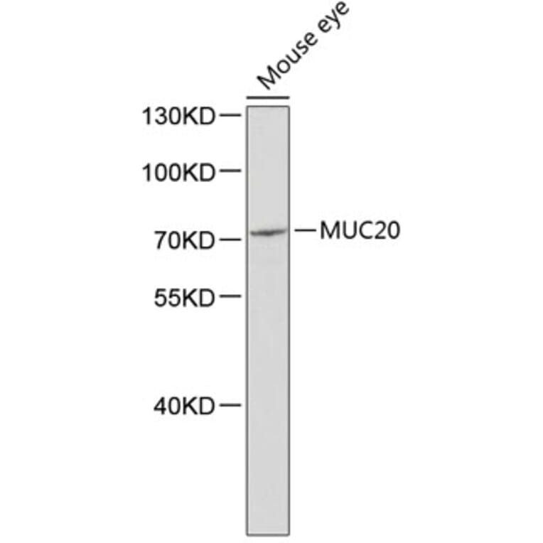 Western Blot - Anti-MUC20 Antibody (A2766) - Antibodies.com