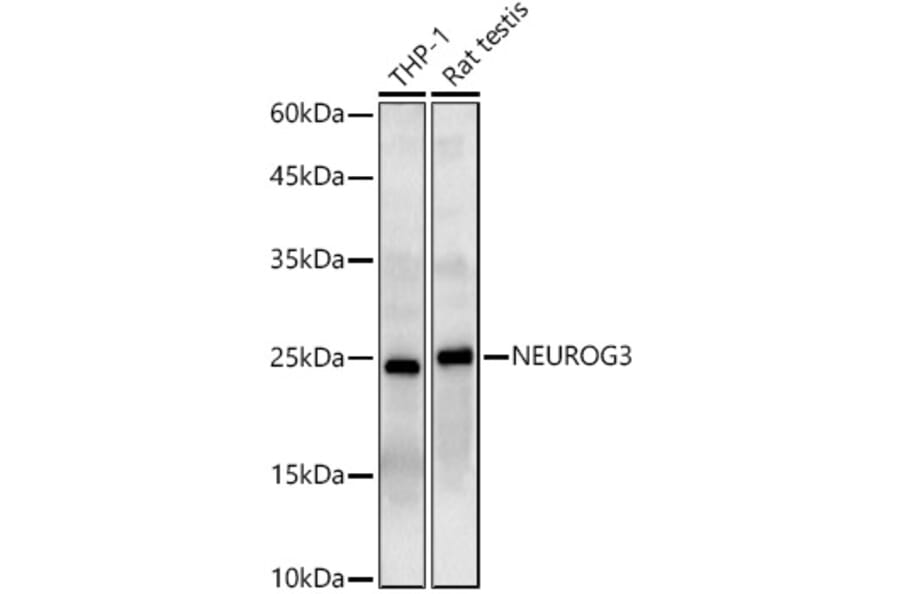 Western Blot - Anti-Neurogenin3/NGN-3 Antibody (A11561) - Antibodies.com