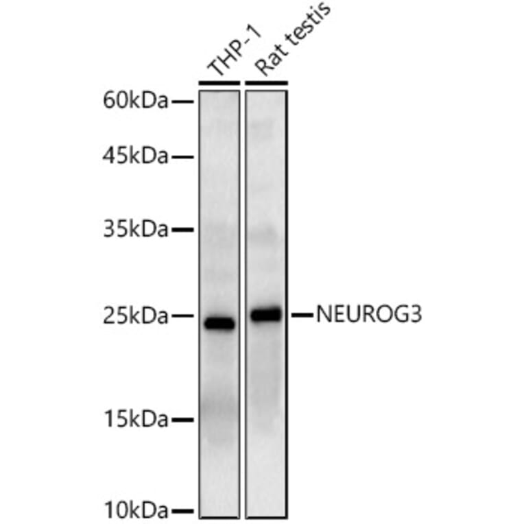Western Blot - Anti-Neurogenin3/NGN-3 Antibody (A11561) - Antibodies.com