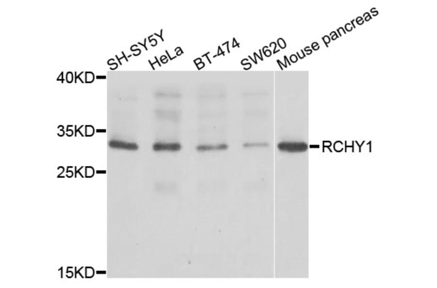 Western Blot - Anti-RCHY1 Antibody (A2789) - Antibodies.com
