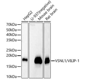 Western Blot - Anti-VILIP1 Antibody (A11565) - Antibodies.com