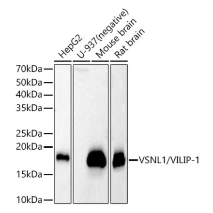 Western Blot - Anti-VILIP1 Antibody (A11565) - Antibodies.com