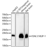 Western Blot - Anti-VILIP1 Antibody (A11565) - Antibodies.com