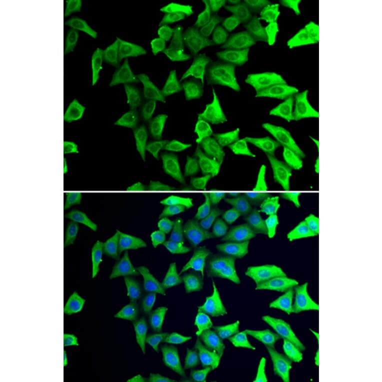 Immunofluorescence - Anti-VILIP1 Antibody (A11565) - Antibodies.com