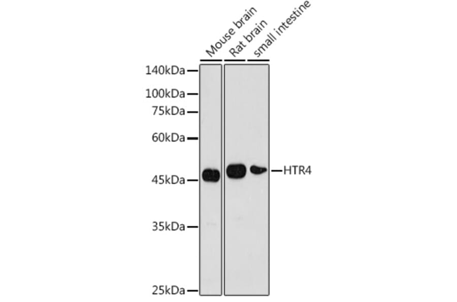 Western Blot - Anti-5HT4 Receptor Antibody (A11566) - Antibodies.com