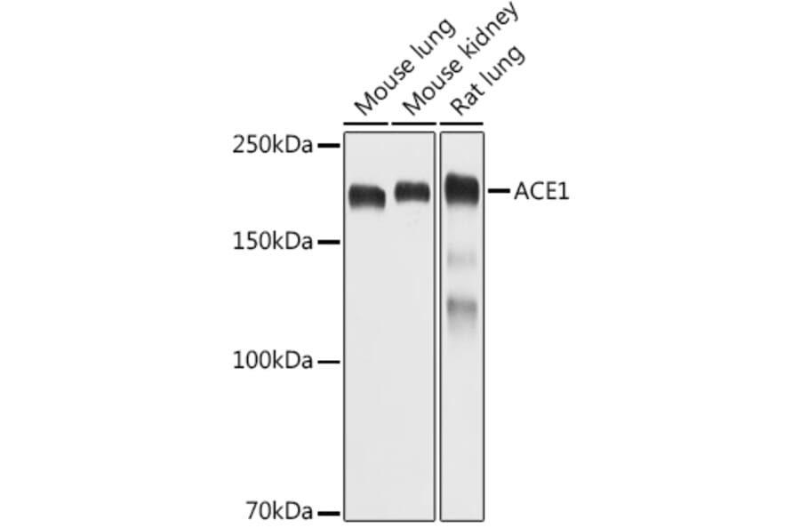 Western Blot - Anti-Angiotensin Converting Enzyme 1 Antibody (A11567) - Antibodies.com