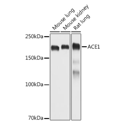 Western Blot - Anti-Angiotensin Converting Enzyme 1 Antibody (A11567) - Antibodies.com