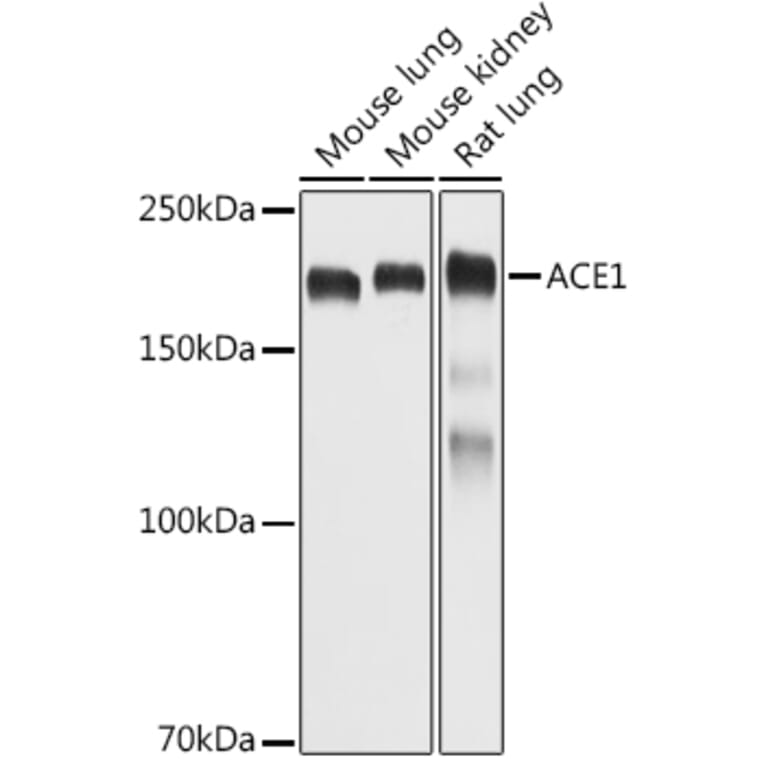 Western Blot - Anti-Angiotensin Converting Enzyme 1 Antibody (A11567) - Antibodies.com