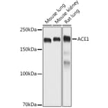 Western Blot - Anti-Angiotensin Converting Enzyme 1 Antibody (A11567) - Antibodies.com