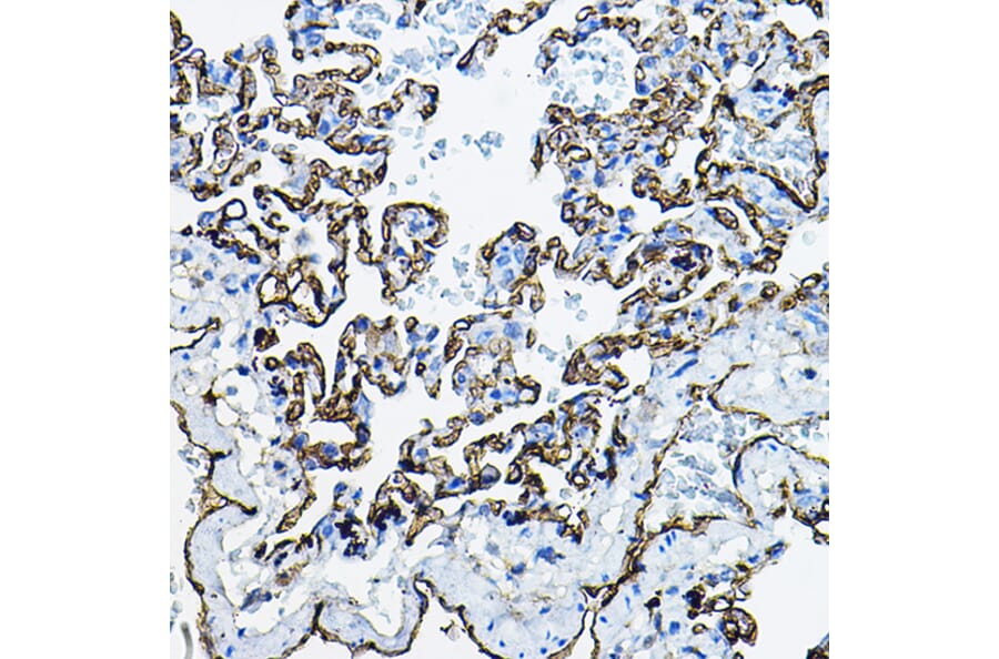 Immunohistochemistry - Anti-Angiotensin Converting Enzyme 1 Antibody (A11567) - Antibodies.com
