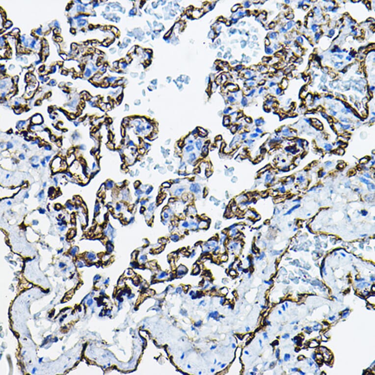 Immunohistochemistry - Anti-Angiotensin Converting Enzyme 1 Antibody (A11567) - Antibodies.com