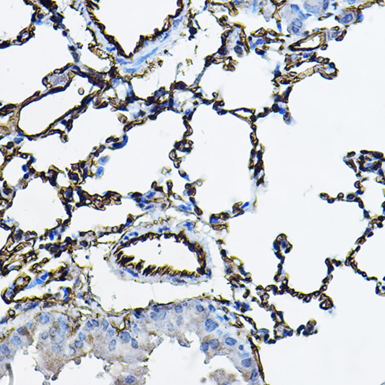 Immunohistochemistry - Anti-Angiotensin Converting Enzyme 1 Antibody (A11567) - Antibodies.com