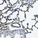 Immunohistochemistry - Anti-Angiotensin Converting Enzyme 1 Antibody (A11567) - Antibodies.com