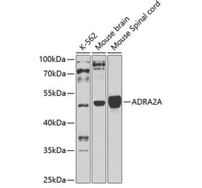 Western Blot - Anti-alpha 2a Adrenergic Receptor Antibody (A11568) - Antibodies.com