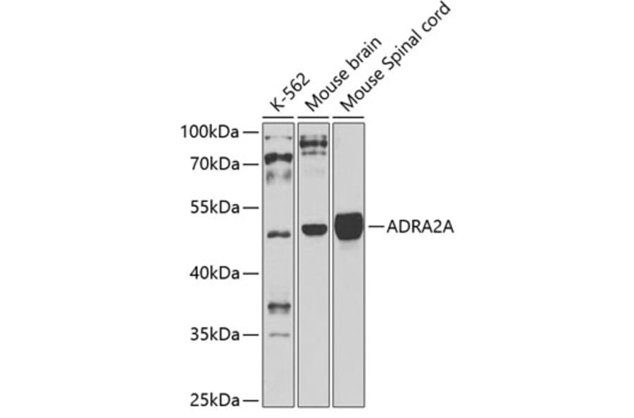 Western Blot - Anti-alpha 2a Adrenergic Receptor Antibody (A11568) - Antibodies.com