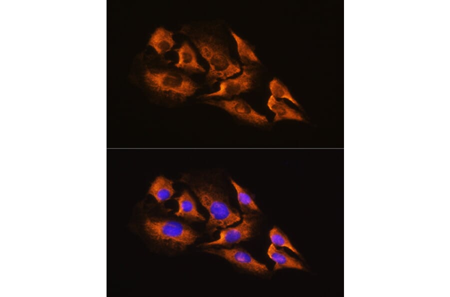 Immunofluorescence - Anti-alpha 2a Adrenergic Receptor Antibody (A11568) - Antibodies.com