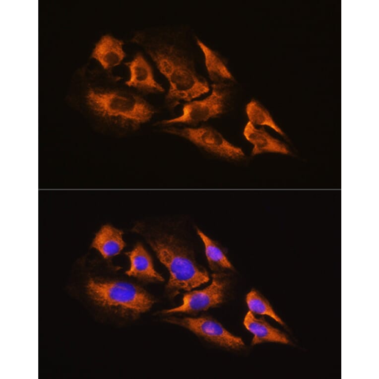 Immunofluorescence - Anti-alpha 2a Adrenergic Receptor Antibody (A11568) - Antibodies.com