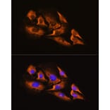 Immunofluorescence - Anti-alpha 2a Adrenergic Receptor Antibody (A11568) - Antibodies.com