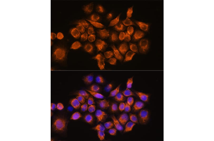Immunofluorescence - Anti-alpha 2a Adrenergic Receptor Antibody (A11568) - Antibodies.com