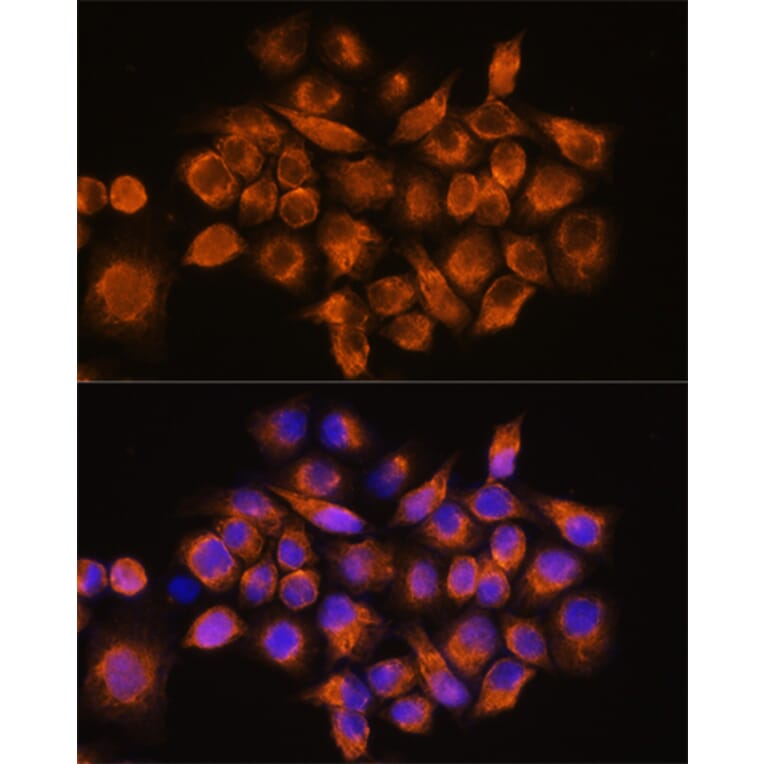 Immunofluorescence - Anti-alpha 2a Adrenergic Receptor Antibody (A11568) - Antibodies.com