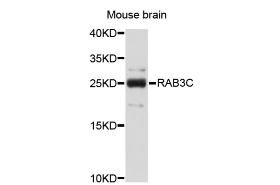 Western Blot - Anti-RAB3C Antibody (A2823) - Antibodies.com
