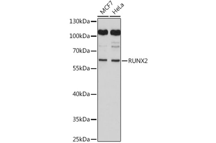 Western Blot - Anti-RUNX2 Antibody (A11571) - Antibodies.com