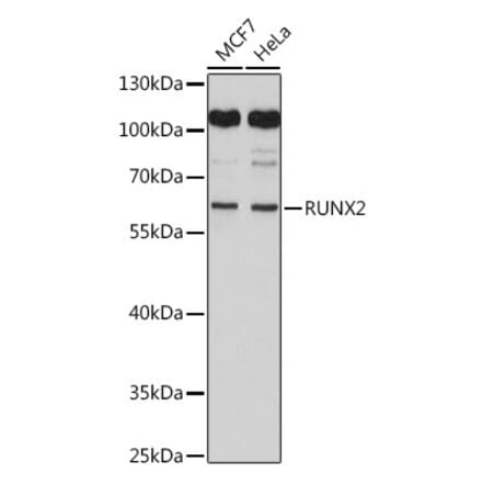 Western Blot - Anti-RUNX2 Antibody (A11571) - Antibodies.com