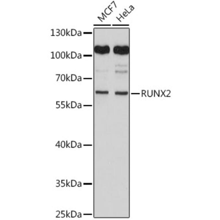 Western Blot - Anti-RUNX2 Antibody (A11571) - Antibodies.com