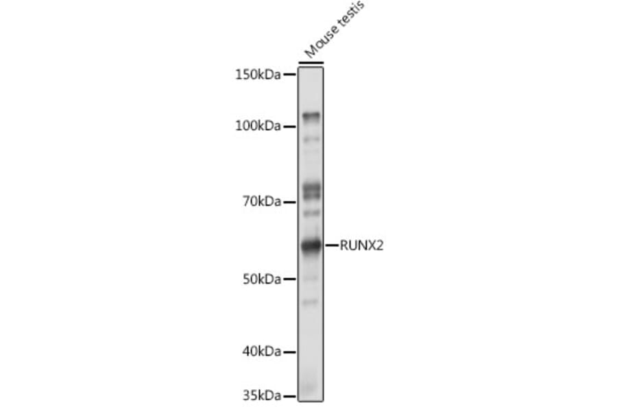 Western Blot - Anti-RUNX2 Antibody (A11571) - Antibodies.com