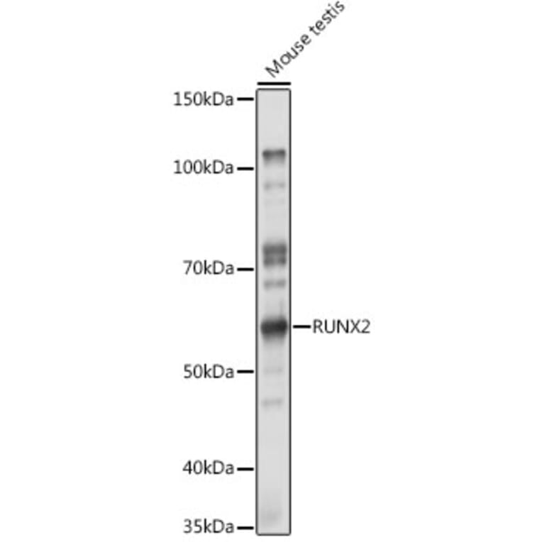 Western Blot - Anti-RUNX2 Antibody (A11571) - Antibodies.com