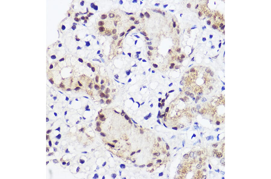 Immunohistochemistry - Anti-RUNX2 Antibody (A11571) - Antibodies.com