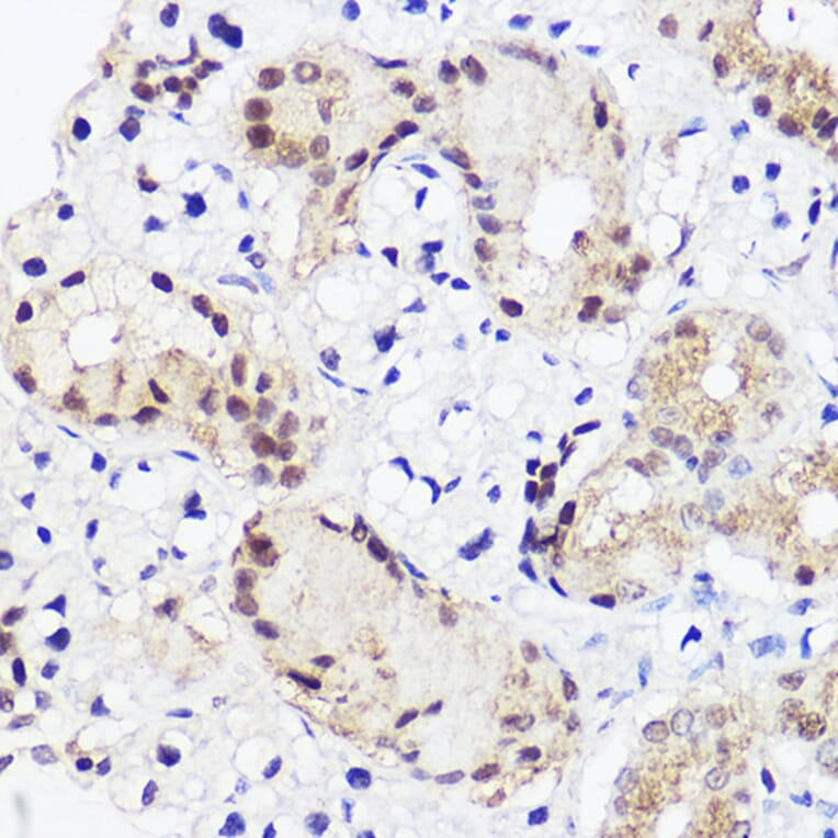 Immunohistochemistry - Anti-RUNX2 Antibody (A11571) - Antibodies.com