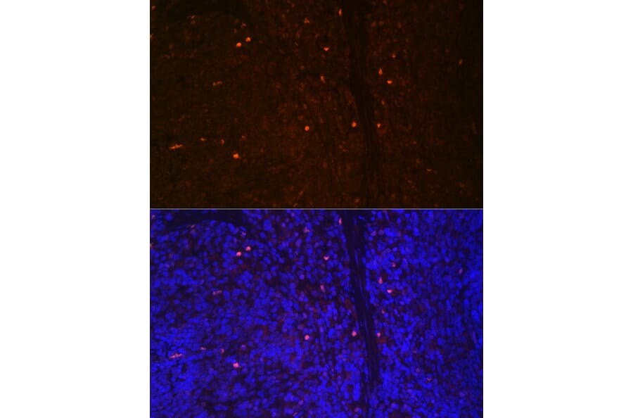 Immunofluorescence - Anti-RUNX2 Antibody (A11571) - Antibodies.com