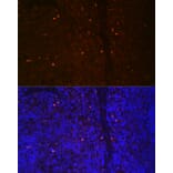 Immunofluorescence - Anti-RUNX2 Antibody (A11571) - Antibodies.com